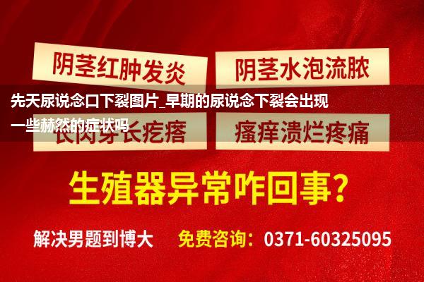 先天尿说念口下裂图片_早期的尿说念下裂会出现一些赫然的症状吗